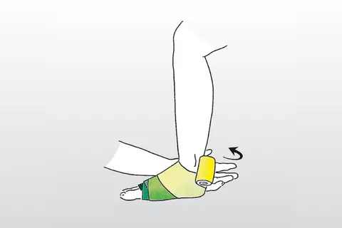 Wicklung des Venenverbandes Stufe 3