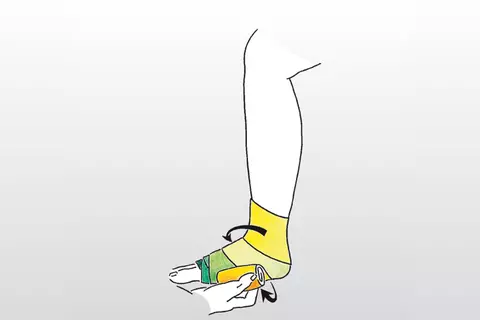 Wicklung des Venenverbandes Stufe 4