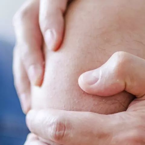 Ein Mann hält sich das Knie wegen Arthrose-Schmerzen